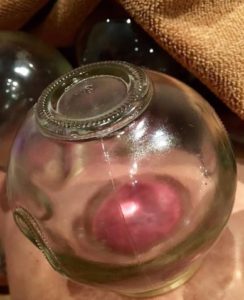 cupping close