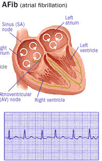 Image Result For Can Blood Clots Image Result For Can Blood Clots